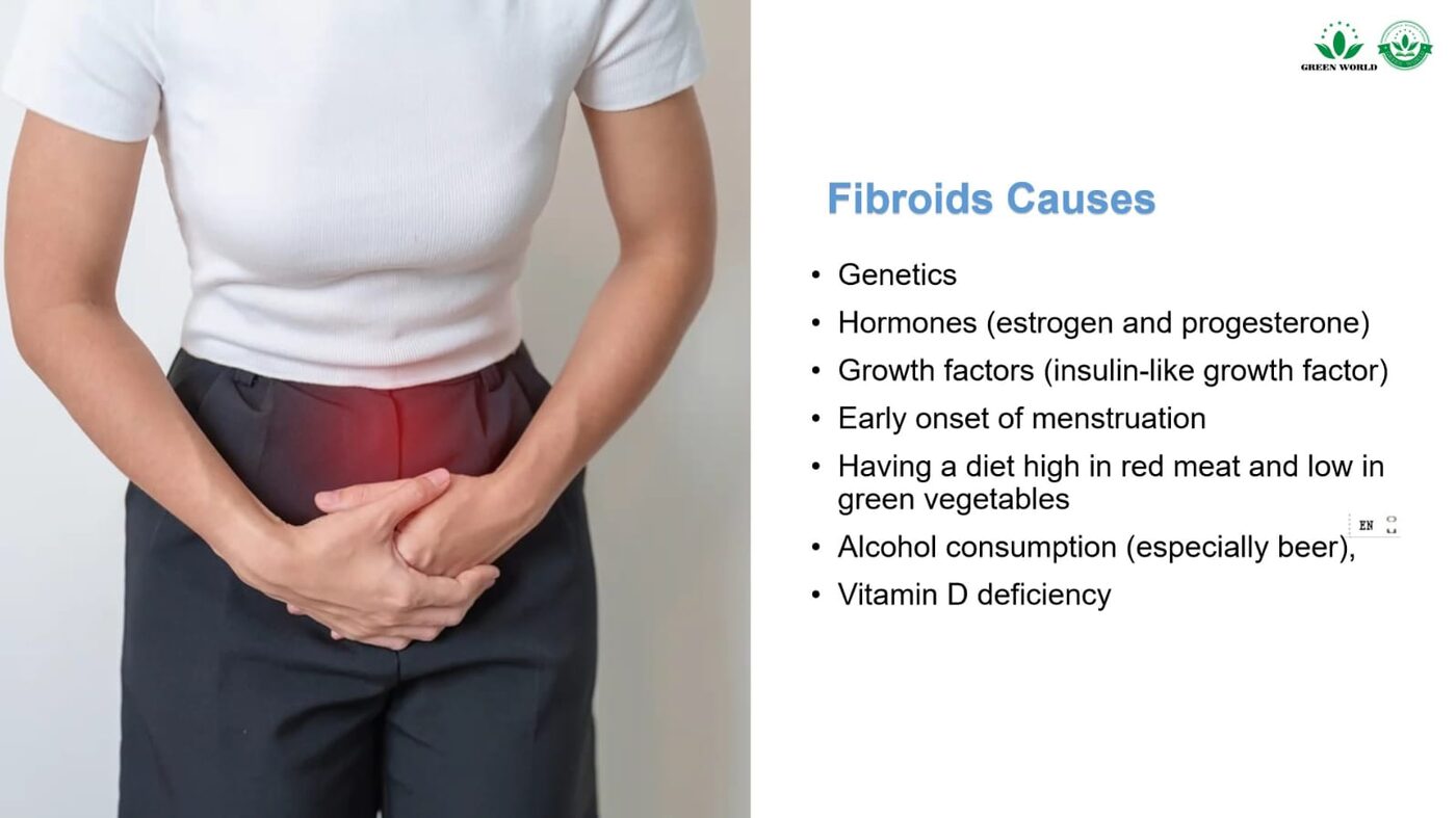 Woman holding her lower abdomen in discomfort, illustrating fibroid causes